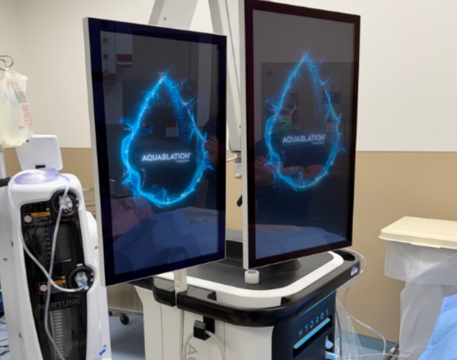 Tecnología Aquablation con pantallas táctiles médicas Tecnología Aquablation con pantallas táctiles médicas